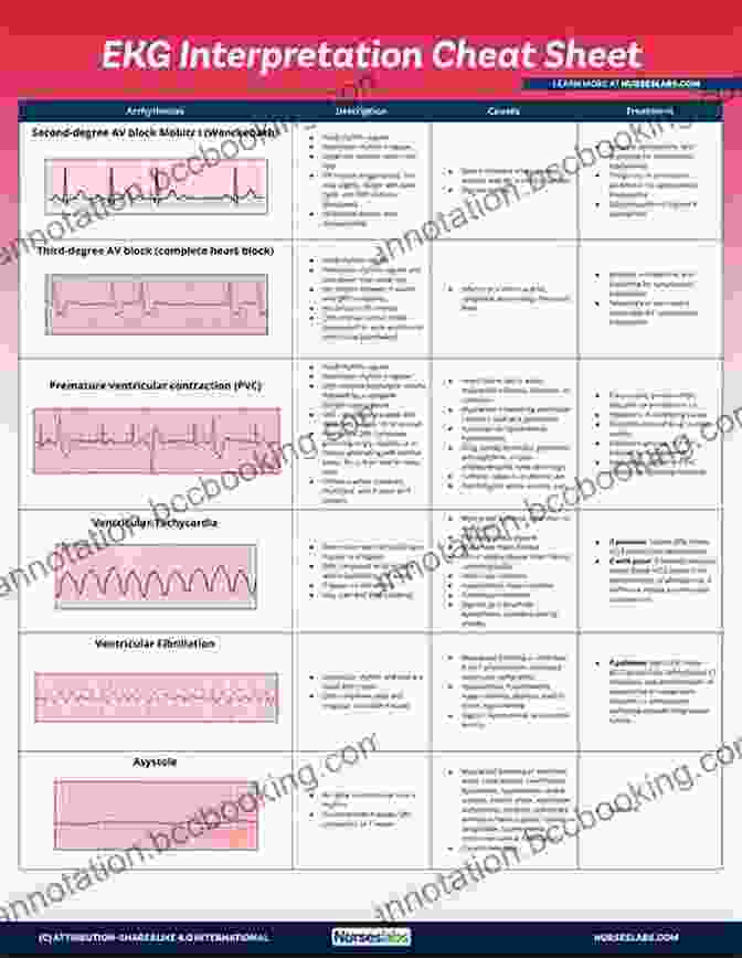 Types Of Arrhythmias ECG / EKG Interpretation: A Systematic Approach To Read A 12 Lead ECG And Interpreting Heart Rhythms In 15 Seconds Or Less Without Memorization