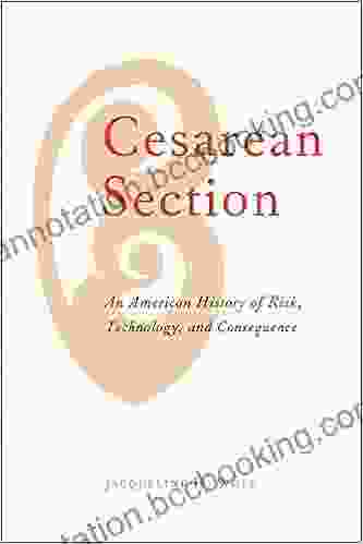 Cesarean Section Jacqueline H Wolf