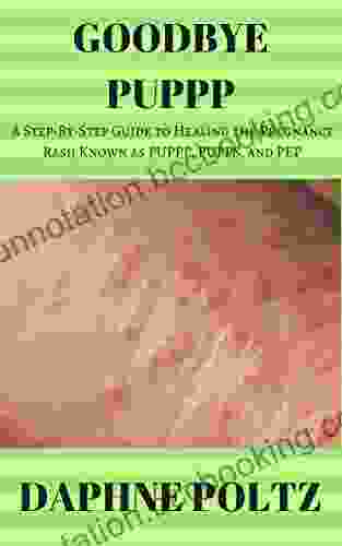 Goodbye PUPPP: A Step By Step Guide To Healing The Pregnancy Rash Known As PUPPP PUPPS And PEP